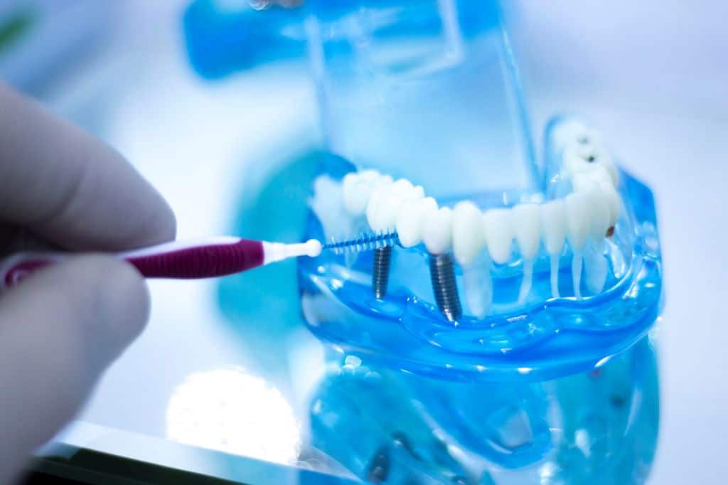 how to maintain dental implants