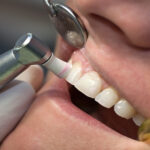 teeth cleaning offers near me