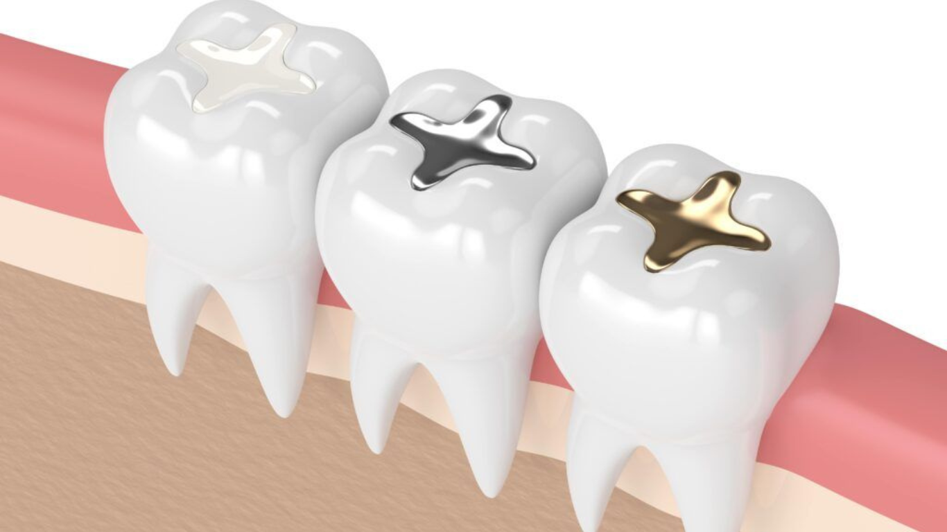 cost of tooth filling in thane