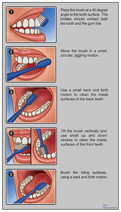 BRUSHING TECHNIQUE