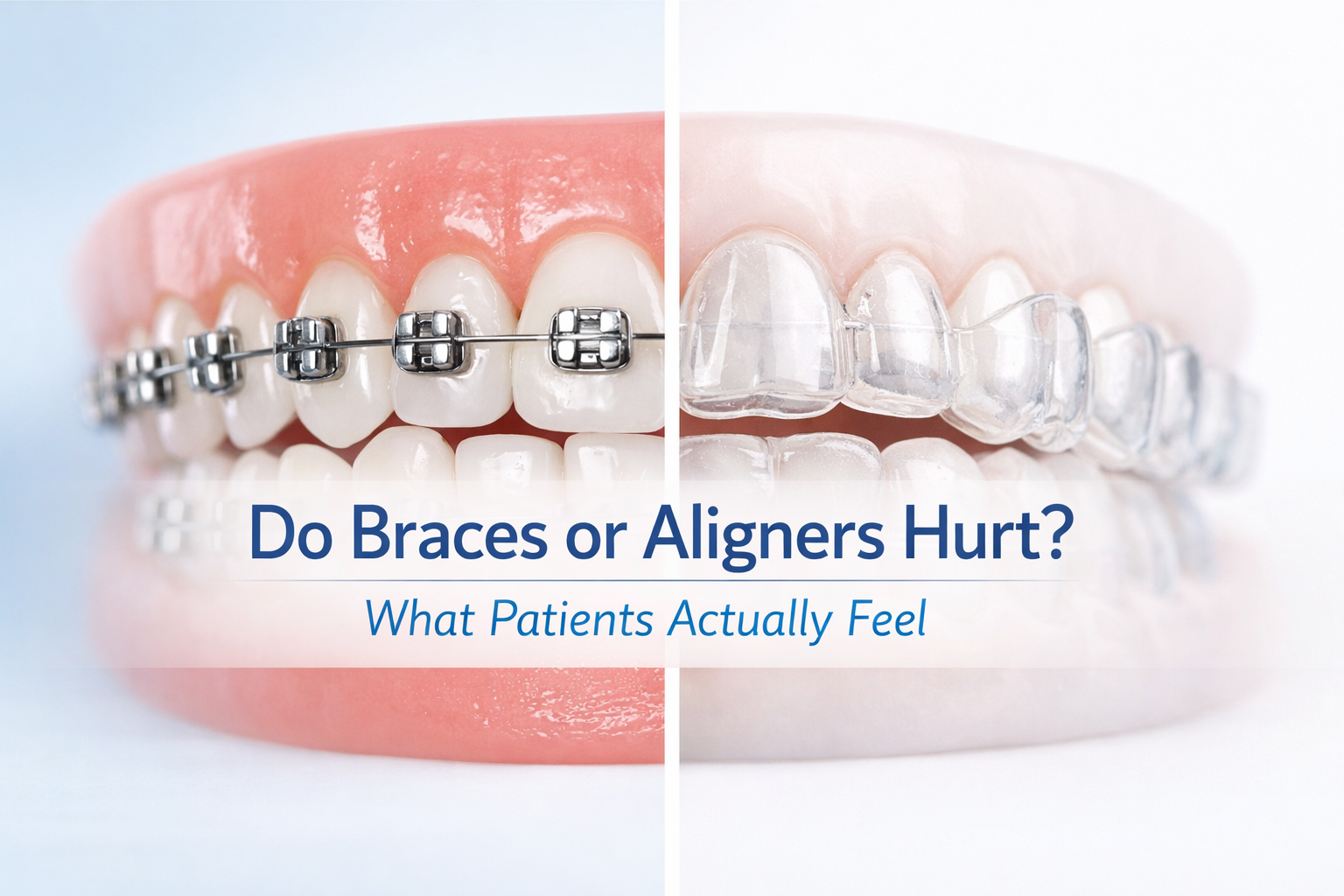 braces vs aligners in thane